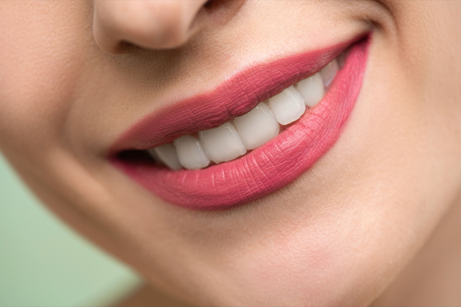Sorriso, resultado de tratamento na RVS Odontologia